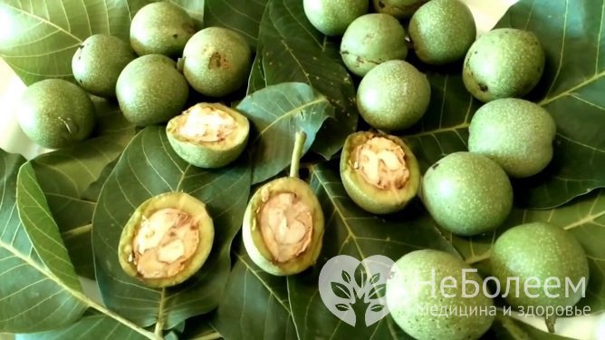 Зеленые грецкие орехи могут применяться в лечении папиллом
