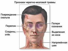 Признаки черепно-мозговой травмы