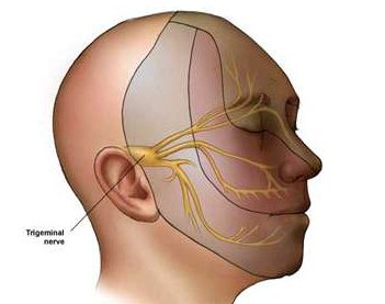 Неврит троичного нерва