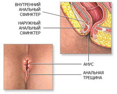 Анальный сфинктер