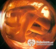 Размер плода на 18 неделе беременности - 20-22 см