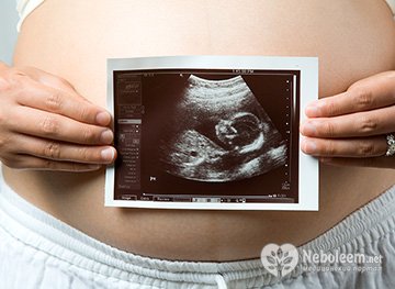 Хирургический аборт на большом сроке