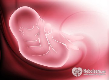 Хирургический аборт на 14 неделе