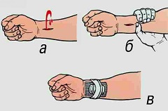 Первая помощь при несчастных случаях - остановка кровотечения