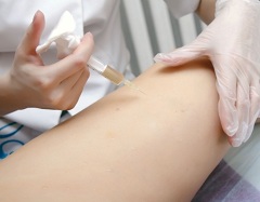 Мезотерапия - это техника введения специального препарата под кожу