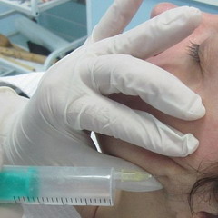 При озонотерапии лица подкожные инъекции делаются в местах локализации морщин
