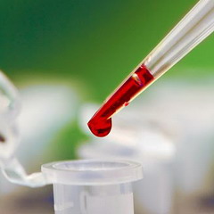Анализ крови на липазу