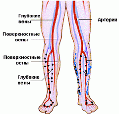 Болезнь Бюргера нижних конечностей