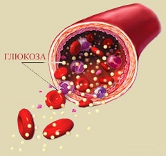 Гипергликемия - повышенное содержание в крови глюкозы