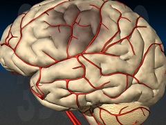 Нарушение мозгового кровообращения - это нарушение кровообращения в системе сосудов головного и спинного мозга