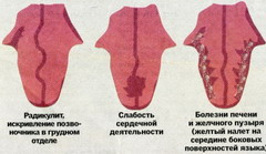 Почему болит кончик языка - определение причины