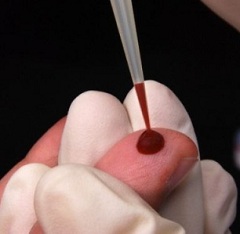 Наличие высокого гемоглобина можно определить с помощью простого анализа крови