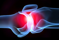 Остеоартрит - одна из причин возникновения суставной боли