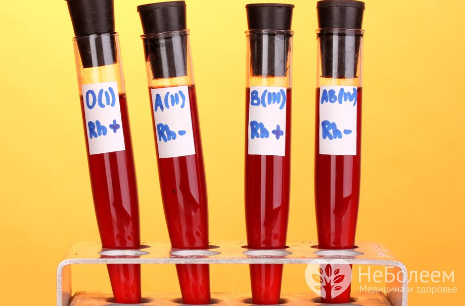 Диета по группе крови – система питания, основанная на особенностях обмена веществ организма и его подверженности определенным заболеваниям