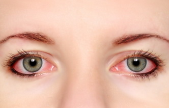 10 причин покраснения глаз