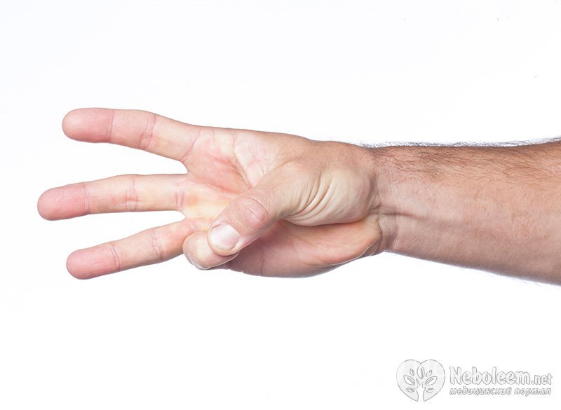 Память пальцев рук. Онемение большого и указательного пальцев.