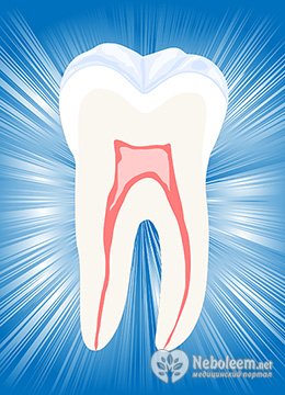 Болит зуб после пломбирования каналов - возможные причины