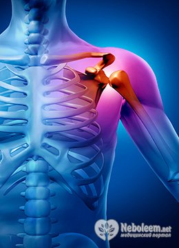 Методы лечения боли в мышцах плеча