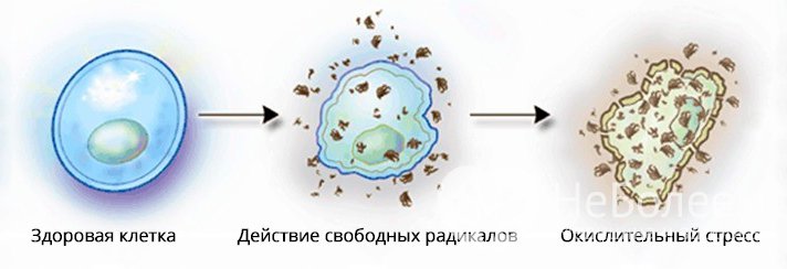 Чем опасны свободные радикалы?