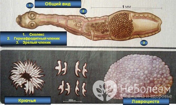 Общий вид Alveococcus multilocularis