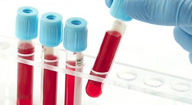 Серологическое исследование позволяет выявить нарастание титра антител в сыворотке крови
