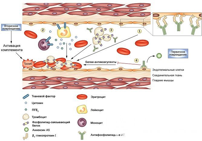 Патогенез антифосфолипидного синдрома