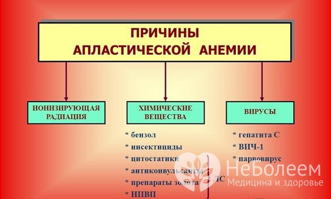 Основные причины апластической анемии