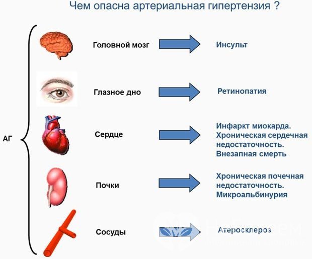 Отдаленные последствия артериальной гипертензии