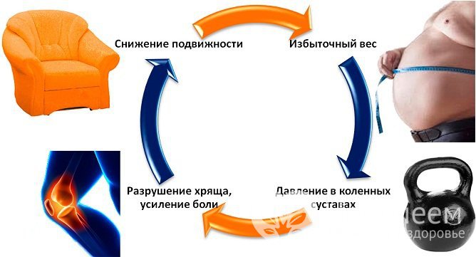 Факторы, способствующие развитию артроза