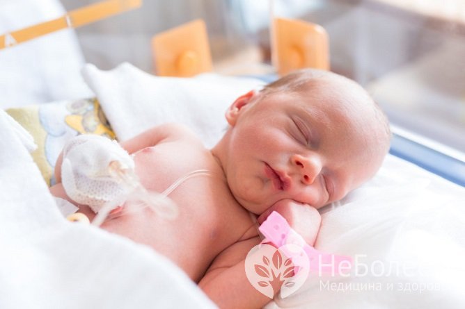 Асфиксия у новорожденных может быть обусловлена аспирацией околоплодных вод или родовой травмой