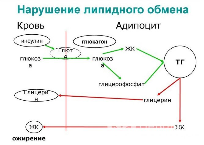 Главной предпосылкой развития атеросклероза нижних конечностей является нарушение липидного обмена