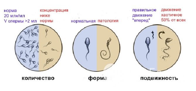 Показатели спермограммы: норма и патологии