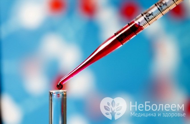Для исключения злокачественной трансформации дермоидной кисты проводят исследования крови на онкомаркеры