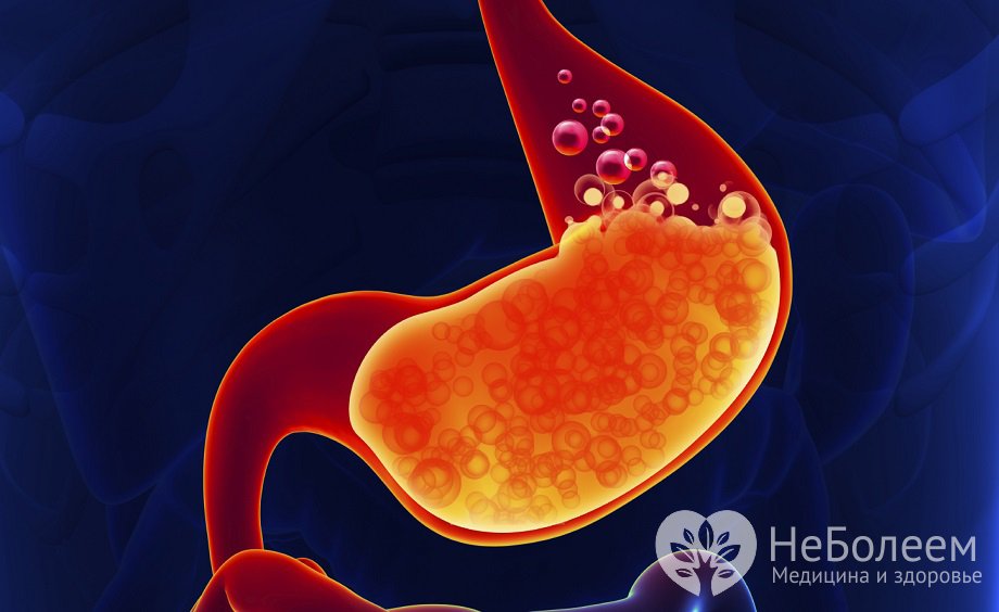 Признаки гастрита с повышенной кислотностью