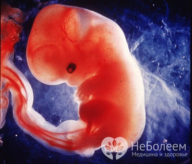 Гемангиома печени развивается вследствие нарушения процессов закладки сосудов венозного русла у плода в первом триместре беременности
