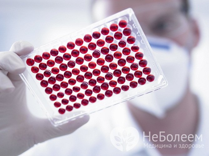 Серологическое исследование позволяет выявить антитела к гемофильной палочке в сыворотке крови