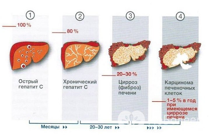 Признаки гепатита C