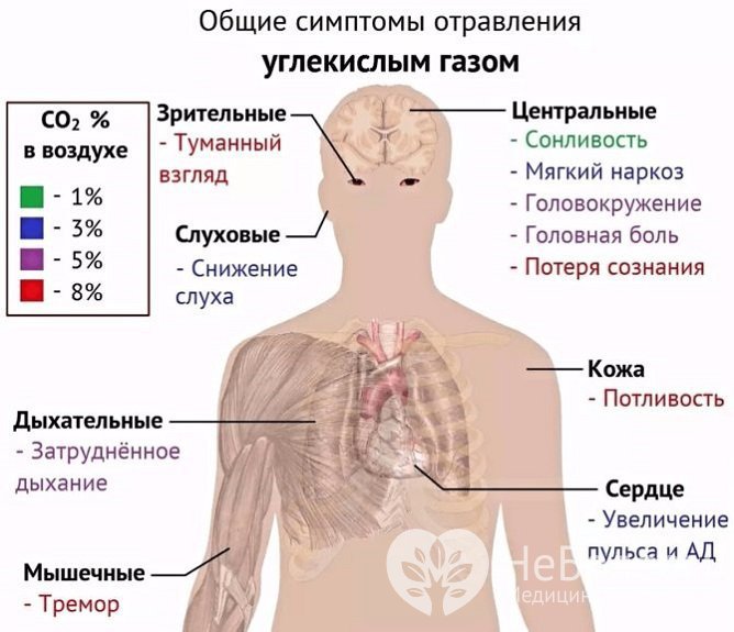 Симптомы гиперкапнии