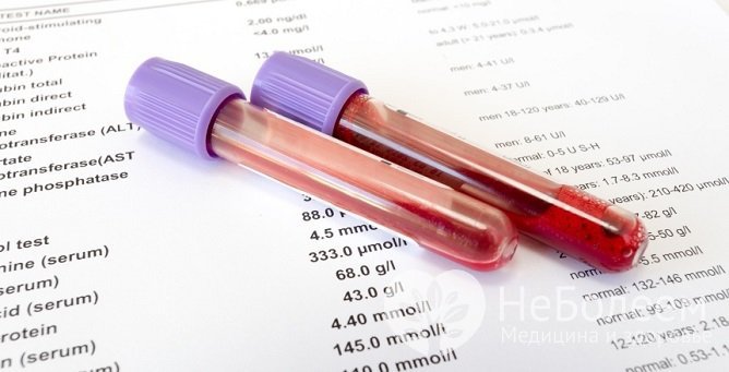 Диагноз «гипергликемическая кома» подтверждается биохимическим исследованием крови