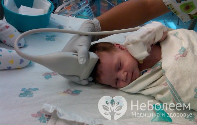 Методы диагностики гипоксии у новорожденных