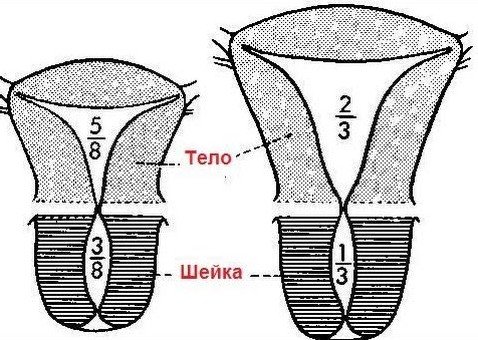 Степени дисплазии матки