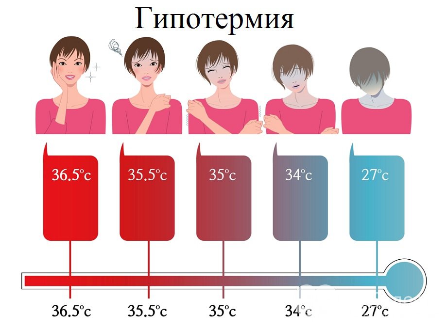 Признаки гипотермии