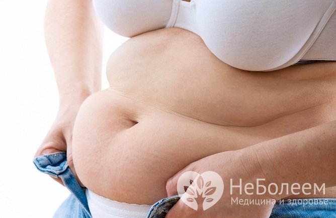 Ожирение, малоподвижный образ жизни – предрасполагающие факторы к грыже поясничного отдела позвоночника