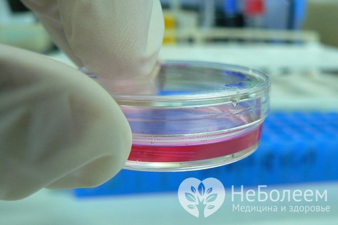 Для диагностики хламидиоза проводят бактериальный посев биологического материала на среду Мак-Коя