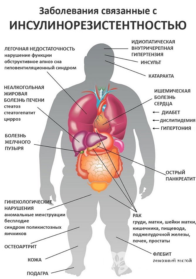 Инсулинорезистентность и связанные с ней заболевания