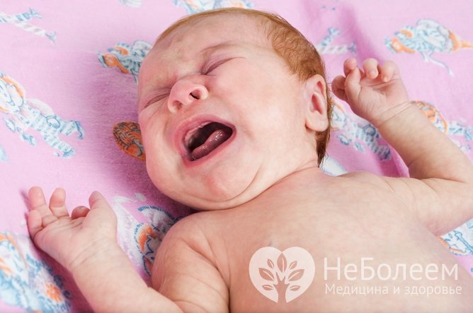 У детей первого года жизни инвагинация кишечника проявляется схваткообразными болями в животе