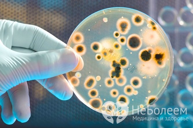 Основной метод диагностики кишечных инфекций – бактериологическое исследование