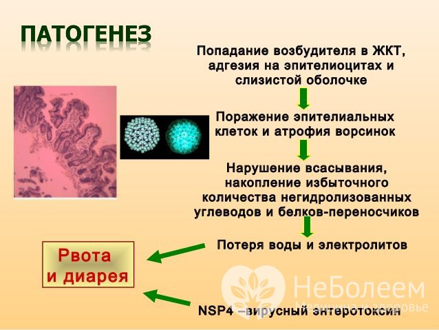 Патогенез кишечного гриппа