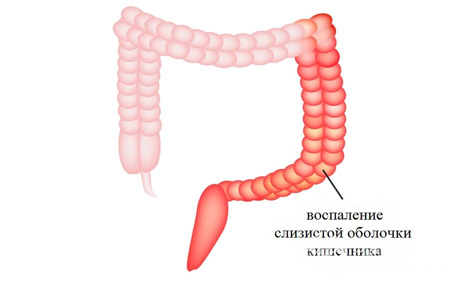 Слизистый слой кишки