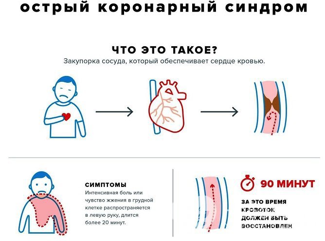 Острая коронарная недостаточность является жизнеугрожающим состоянием